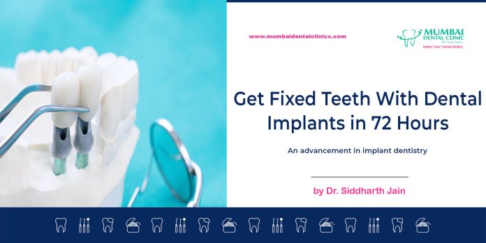 Dental Implant in Udaipur